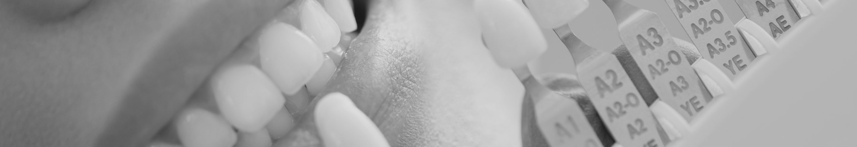 치아 미백